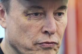Elon Musk’s Black Eye
